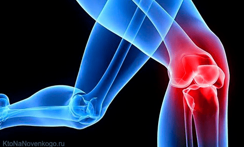 Arthrosis