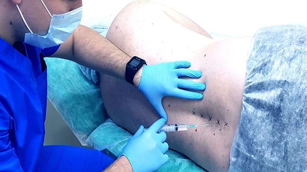 Spinalblock fir Osteochondrosis