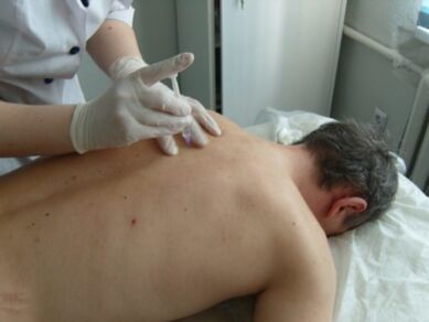 Intraartikuläre Injektiounen vu Chondroprotectoren fir thoracesch Osteochondrose